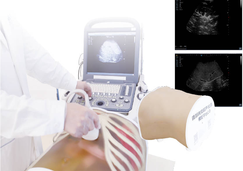 腹部病变超声检查模型平台 2.0