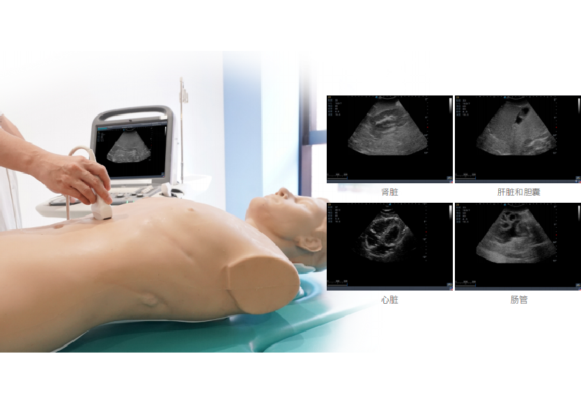 创伤超声重点评估平台 2.0
